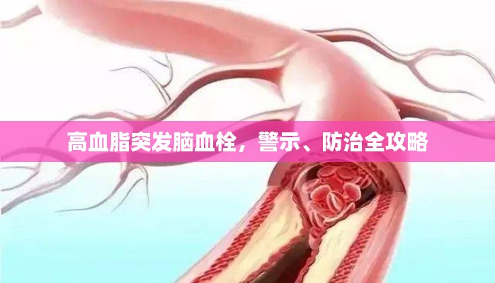 高血脂突发脑血栓,警示、防治全攻略