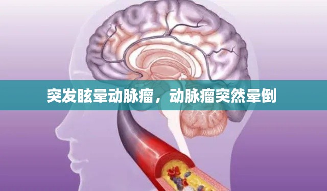 突发眩晕动脉瘤,动脉瘤突然晕倒