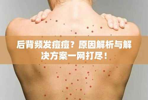 后背频发痘痘?原因解析与解决方案一网打尽!
