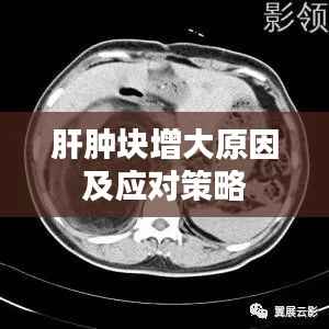 肝肿块增大原因及应对策略